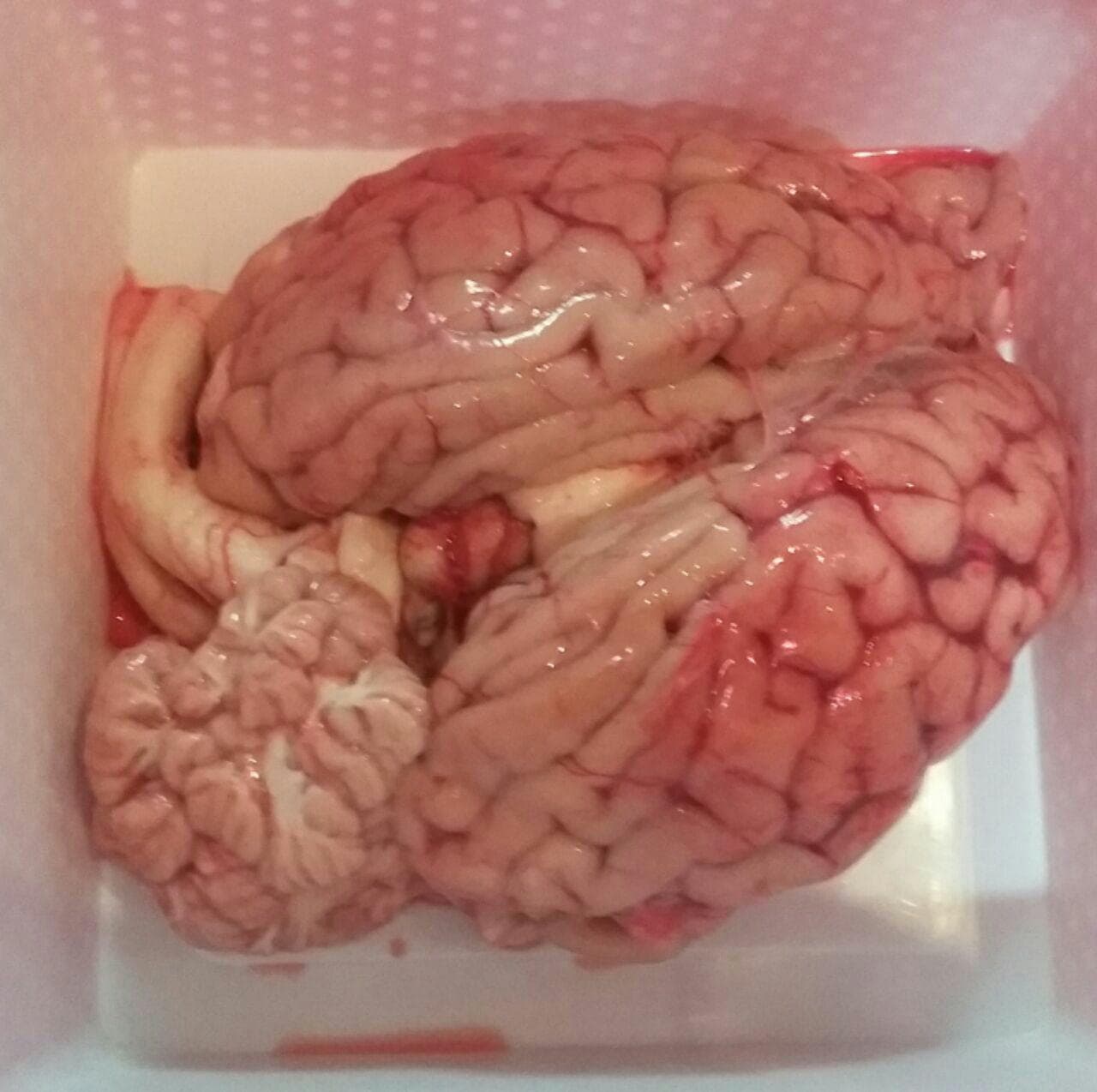 تشریح مغز در سوم دماوند